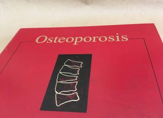 6 συμβουλές για να προστατέψετε τα οστά σας!