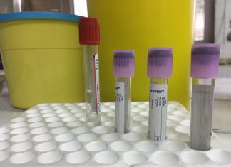 Αντιπηκτική αγωγή: Όσα πρέπει να γνωρίζετε