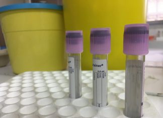 PRP – Platelet Rich Plasma – Πλάσμα Πλούσιο σε αιμοπετάλια