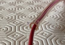 How to protect your arteries from atherosclerosis