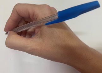 Tενοντοελυτρίτιδα De Quervain