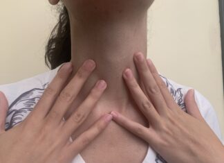 Υπερθυρεοειδισμός