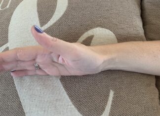 Οστεοπορωτικά Κατάγματα στην Περιοχή του Καρπού