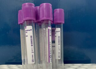 TKE: Ταχύτητα καθίζησης ερυθρών αιμοσφαιρίων