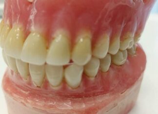 Οστεοπόρωση και Περιοδοντίτιδα