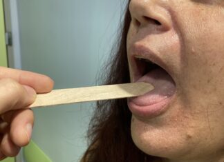 Λοιμώδης Μονοπυρήνωση