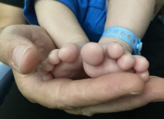 Χαλαρή Πλατυποδία των Παιδιών