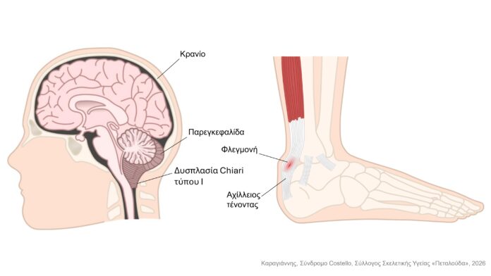 Σύνδρομο Costello - Εικόνες Άρθρου Καραγιάννης